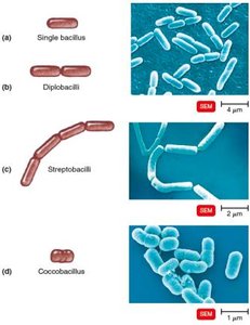 Bacilli arrangements and SEM images