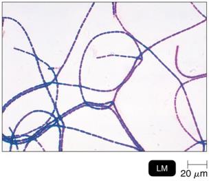 Gram-stained Bacillus anthracis