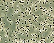 Glycocalyx capsule and slime layer
