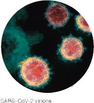 SARS-CoV-2 virions