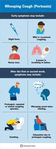 Whooping cough symptoms