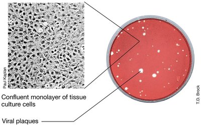Plaque assay in tissue culture