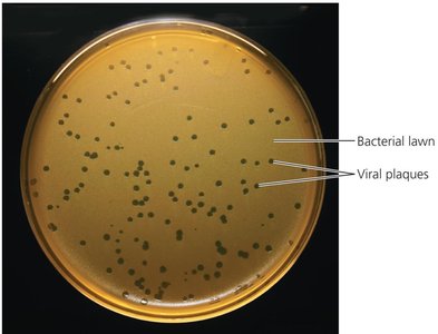 Plaque assay in bacterial lawn