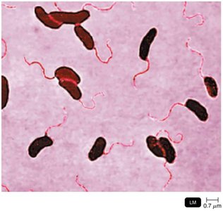 Vibrio cholerae