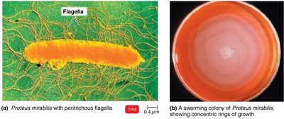 Proteus mirabilis with flagella and swarming colony