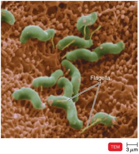 Helicobacter pylori on stomach cells