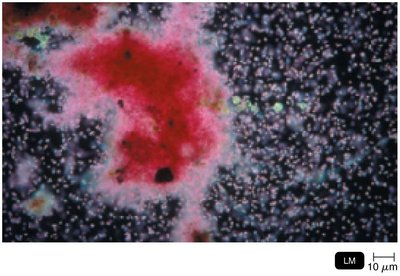 Purple sulfur bacteria