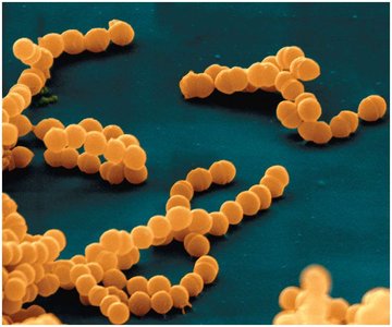 Streptococcus pyogenes chains