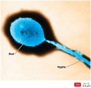 Hyphomicrobium budding bacterium