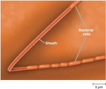 Sphaerotilus Natans with sheath