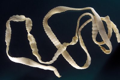 Tapeworm (Taenia species)