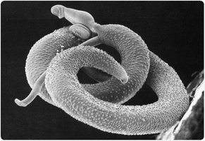 Microscopic image of parasitic worm