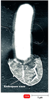 Bacillus anthracis endospore case