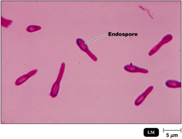 Clostridium endospores under light microscope