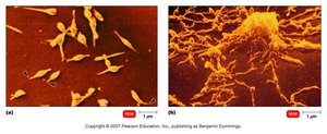 Mycoplasma colonies with fried egg appearance