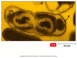 Legionella bacteria in aquatic environment