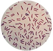 Moraxella lacunata causing conjunctivitis