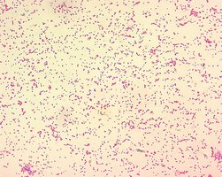 Brucella spp. under microscope