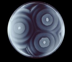 Proteus mirabilis swarming on agar plate