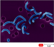 Vibrio cholerae under TEM