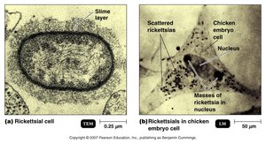 Rickettsia cell and Rickettsia in chicken embryo cell