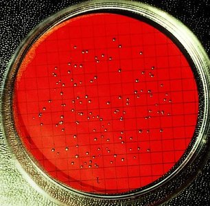 Filtration method for quantifying bacteria