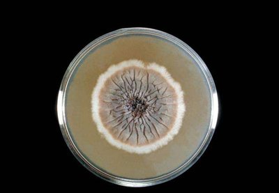 Fungal colony on Sabouraud's Dextrose agar
