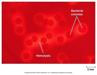 Blood agar showing hemolysis and bacterial colonies