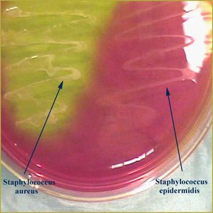 Mannitol Salt Agar differentiating Staphylococcus species
