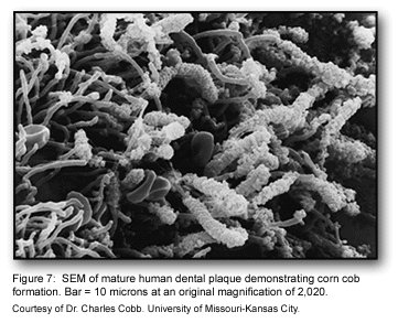SEM of dental plaque biofilm
