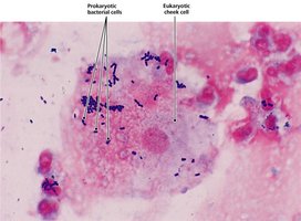 Prokaryotic bacterial cells and eukaryotic cheek cell.