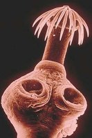 Picture of Taenia solium (pork tapeworm) head (scolex).