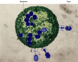 Picture of bacteriophage viruses attached to a cell.