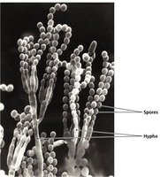 Picture of Aspergillus, a multicellular filamentous fungi.