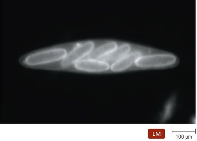 Viviparity in Epulopiscium