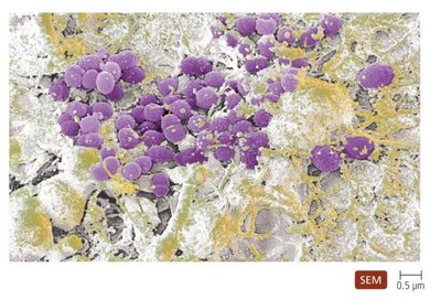 Exotoxins and endotoxins mechanisms