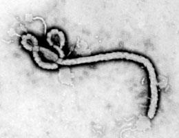 Microscopic image of viruses