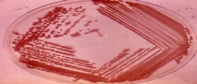 Bacterial colonies on an agar plate