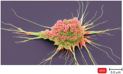 Dendritic cell