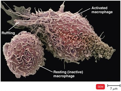 Activated and resting macrophages