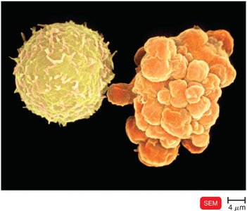 Apoptosis