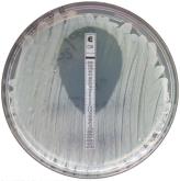 E-test for antibiotic susceptibility