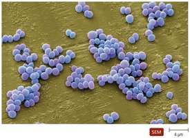 SEM of Staphylococcus clusters