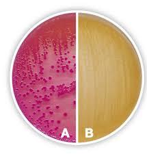 MacConkey agar with pink and colorless colonies