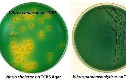 TCBS agar with Vibrio colonies