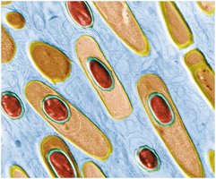 Bacillus anthracis, Bacteria with Endospores
