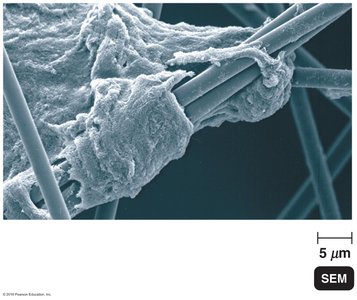 SEM image of biofilm on a surface