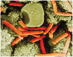 Bacillus anthracis bacteria under microscope