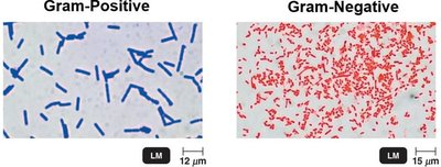 Gram-positive and Gram-negative bacteria after Gram stain