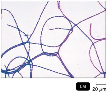 Gram-stained Bacillus anthracis
